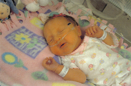 Esta e minha filha Claire, ela e tao linda!
Ela nasceu 6 semanas antes, mas esta  indo super bem.
Darley  Beers
13 Mar 2004