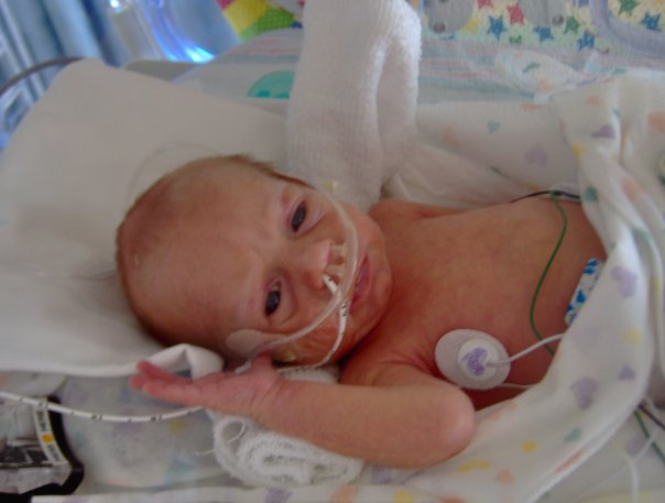 Mi bebe en el hospital un mes y media despues de nacer
Clay  Freeze
22 Nov 2008